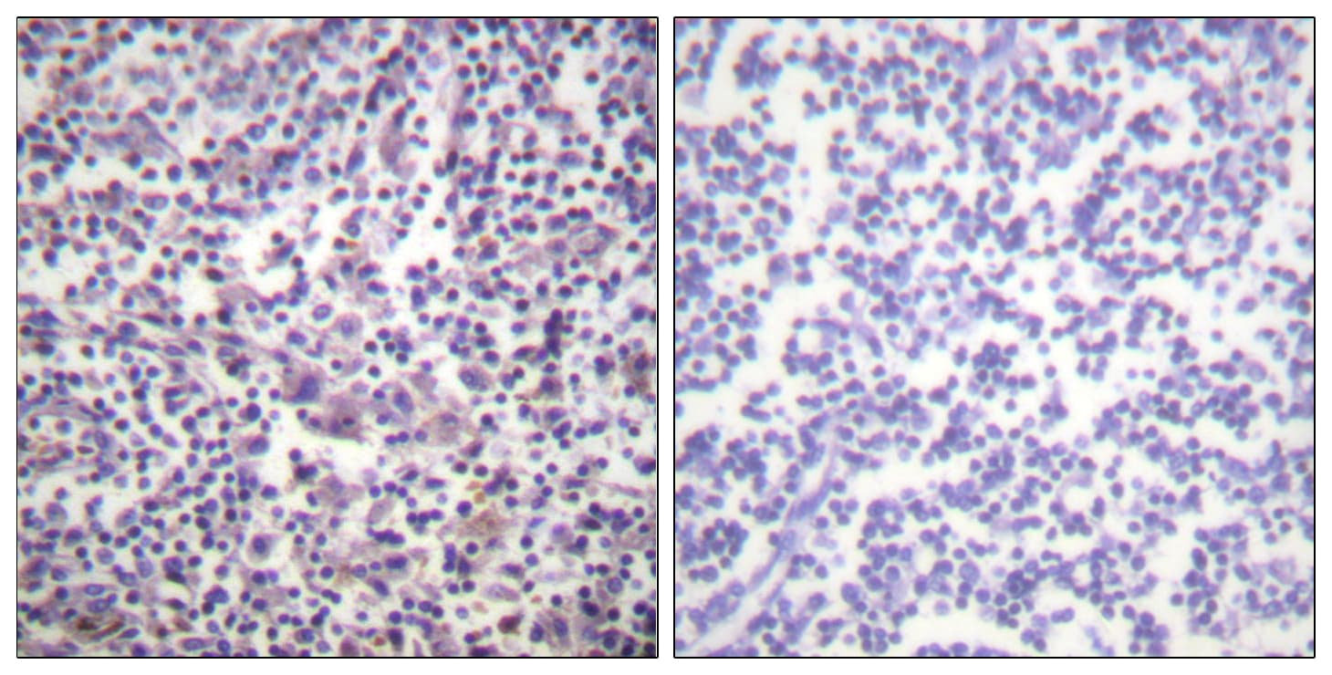 BRAF / B-Raf Antibody (aa576-625)