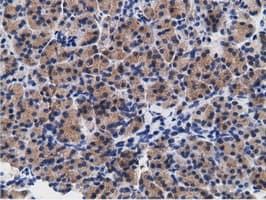 Monoclonal Mouse anti-Human CD80 Antibody (clone OTI2E5, IHC, IF, WB)