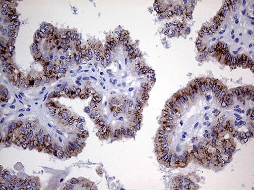 Monoclonal Mouse anti-Human MYOT / Myotilin Antibody (clone OTI5E11, IHC, WB)