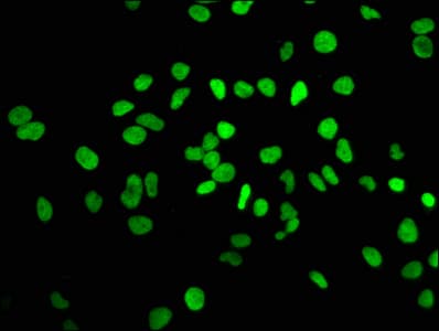Polyclonal Rabbit anti-Human HIST1H3A Antibody (IHC, IF, WB)