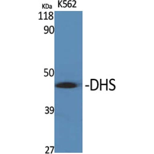 DHPS Antibody (30-110 aa, Internal)