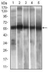 Monoclonal Mouse anti-Human ALDH2 Antibody (clone 4G6A3, Amino Acid: 317-517, IHC, IF, WB)