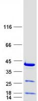 Human RPRD1B Protein (Recombinant Myc-DDK (Flag))