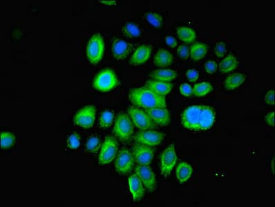 IHC-plus™ LGALS1 / Galectin 1 Antibody (aa2-135)