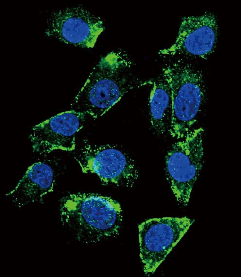 BTC / Betacellulin Antibody (aa17-45)
