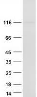 Human BICC1 Protein (Recombinant Myc-DDK (Flag))