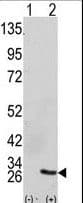 GRB2 Antibody (aa89-118)