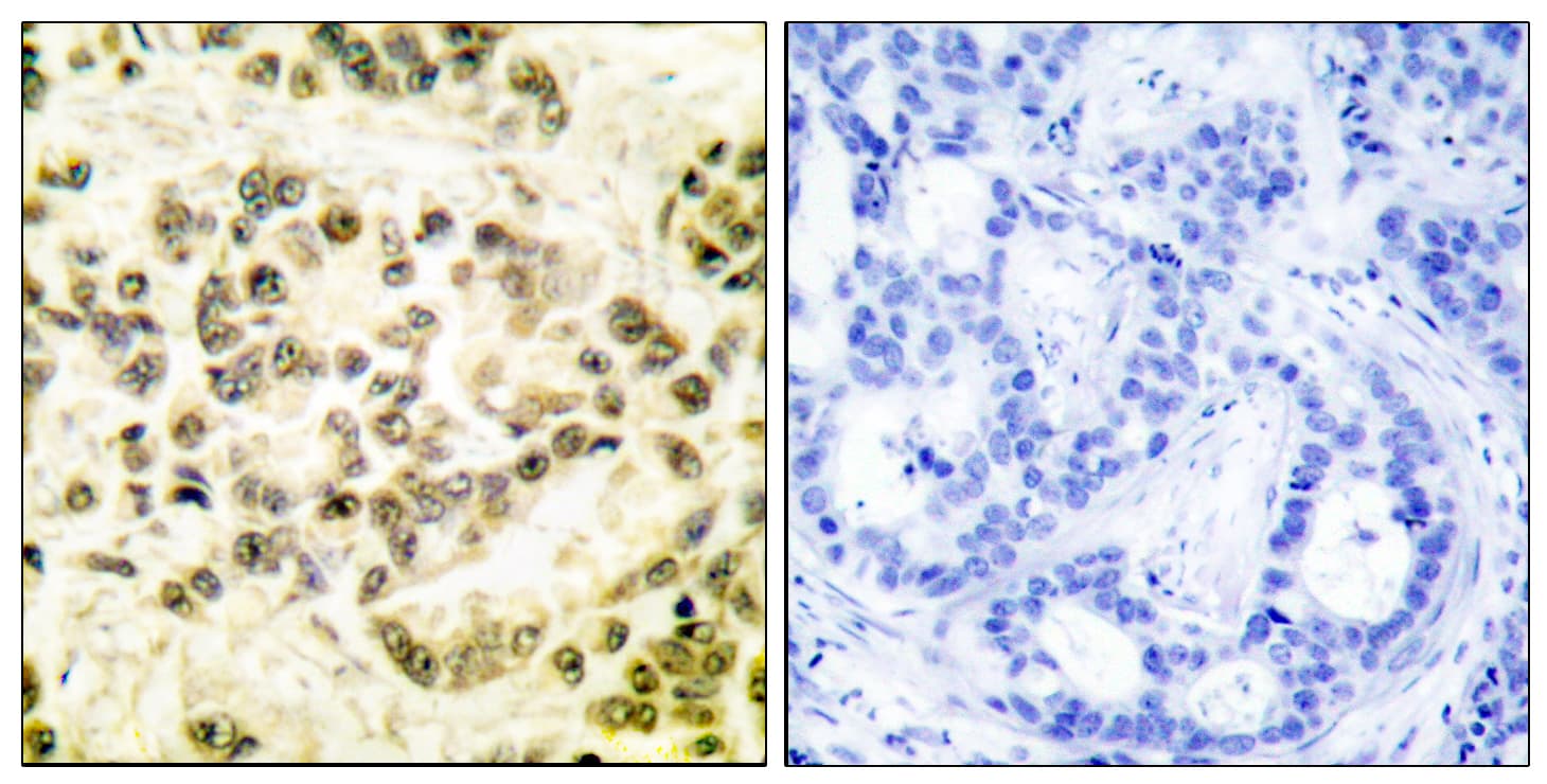 STAT5B Antibody (phospho-Ser731)