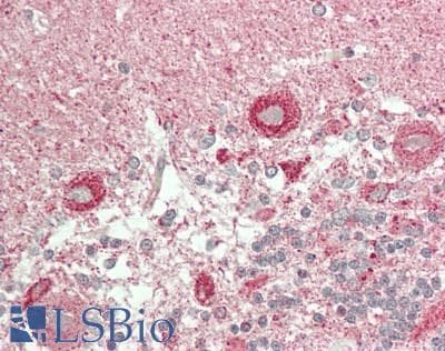 IHC-plus™ EPHA6 / EPH Receptor A6 Antibody (C-Terminus)