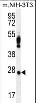 PRDX4 / Peroxiredoxin 4 Antibody (aa82-110)