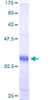 Human TIMM9 Protein (Recombinant GST)