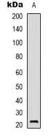 AKIP1 / BCA3 Antibody (Internal)