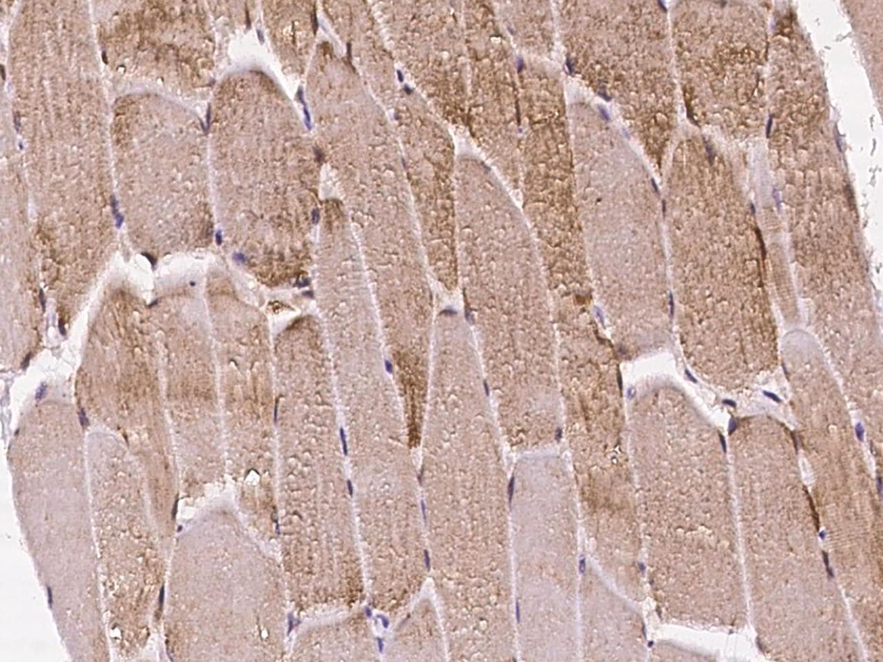 Polyclonal Rabbit anti-Human CLDN12 / Claudin 12 Antibody (IHC)