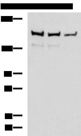 ROCK2 Antibody