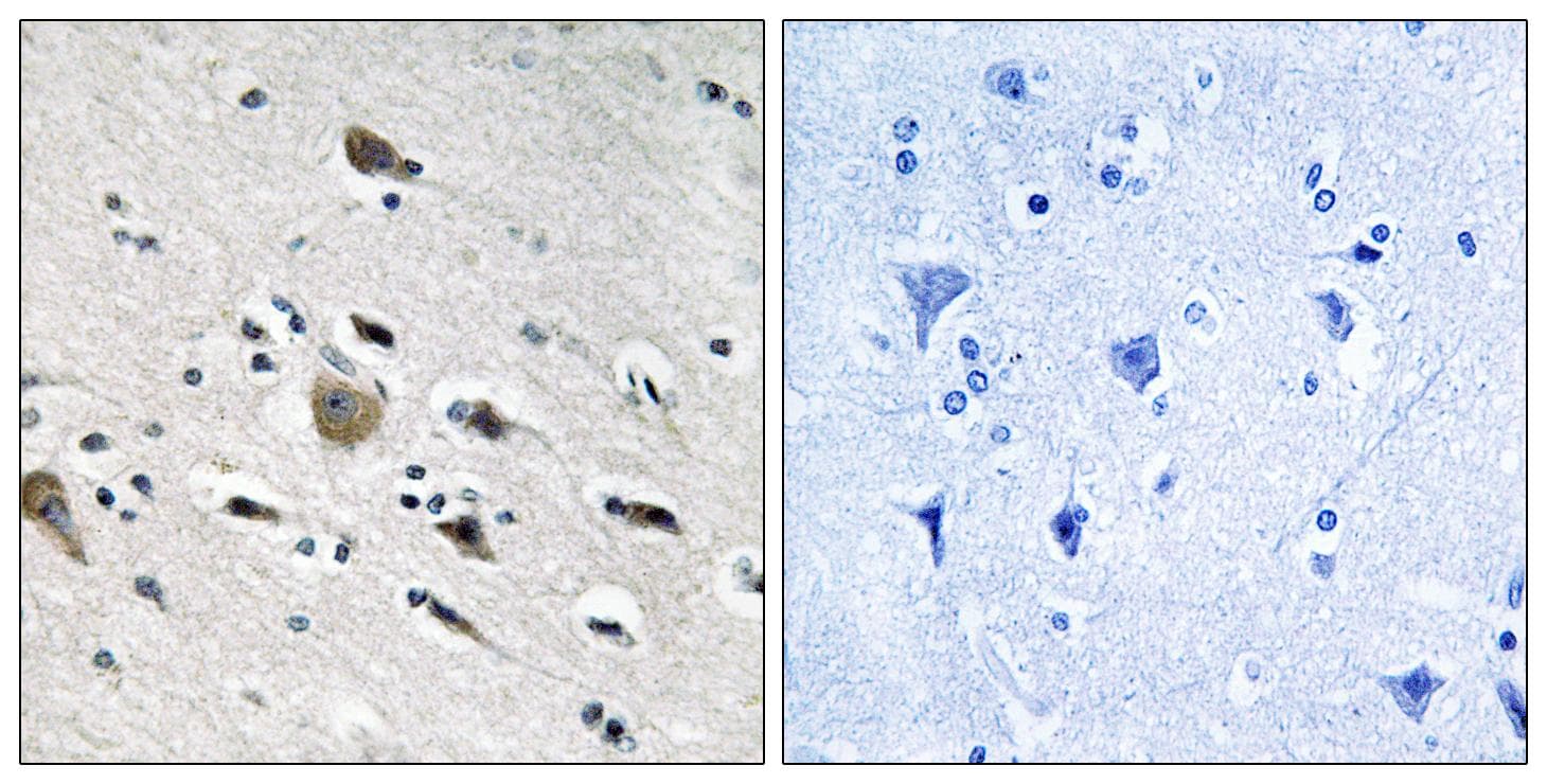 MRPL52 Antibody