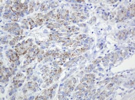 SPN / CD43 Antibody (clone OTI4G8)