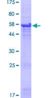 Human TRBV5-4 Protein (Recombinant GST, N-terminus)