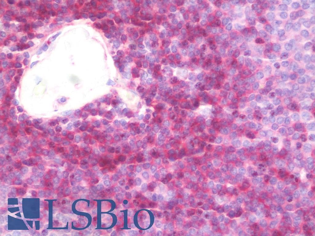 Monoclonal Mouse anti-Human BTLA / CD272 Antibody (clone 2.00E+04, Carrier-free, IHC, WB)