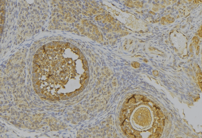 Polyclonal Rabbit anti-Human PGC / Pepsin C Antibody (IHC, IF, WB)