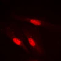 SMAD2 Antibody (Internal)