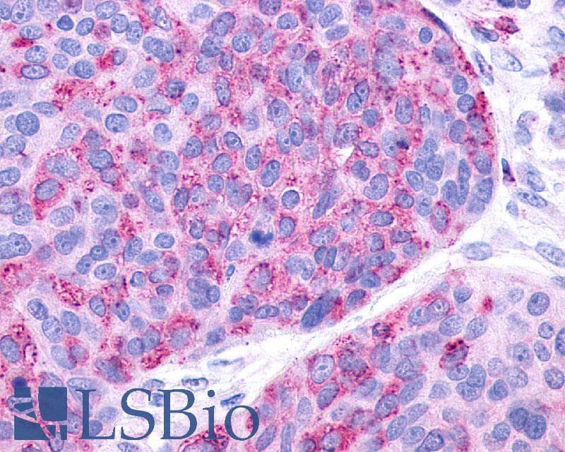 IHC-plus™ Polyclonal Rabbit anti-Human P2Y10 / P2RY10 Antibody (Extracellular Domain, IHC)