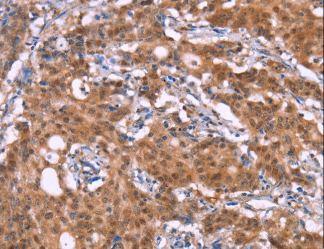 C3orf10 Antibody