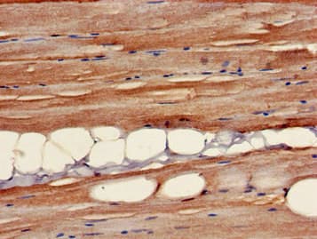 Polyclonal Rabbit anti-Human GALT4 / B3GALT4 Antibody (IHC, WB)
