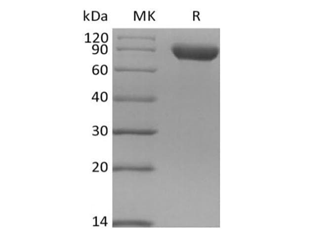Human SIGLEC8 Protein (Recombinant Fc, C-terminus)