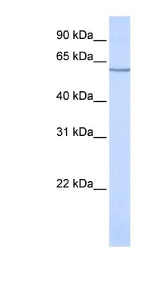 Polyclonal Rabbit anti-Human SLC1A1 / EAAT3 Antibody (aa36-85, WB)