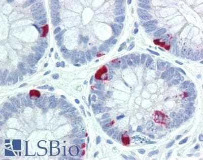 IHC-plus™ Polyclonal Rabbit anti-Human KISS1R / GPR54 Antibody (IHC, WB)