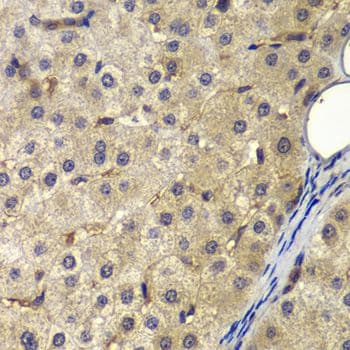 AP2A2 Antibody