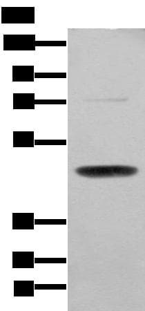 SERPINH1 / HSP47 Antibody