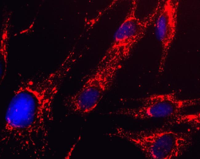 HADH Antibody (clone 1A12BC8)
