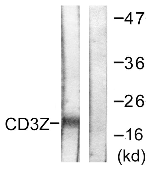 CD247 / CD3 Zeta Antibody (aa111-160)