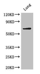 BIRC3 / cIAP2 Antibody