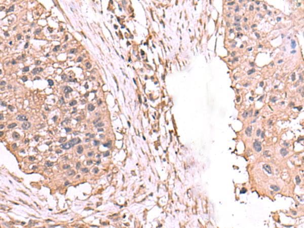 Polyclonal Rabbit anti-Human AHCYL1 / DCAL Antibody (IHC)