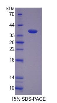 Mouse FBXL3 Protein (Recombinant His-S)