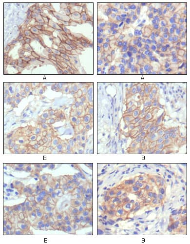 ERBB2 / HER2 Antibody (clone 9B9D8)
