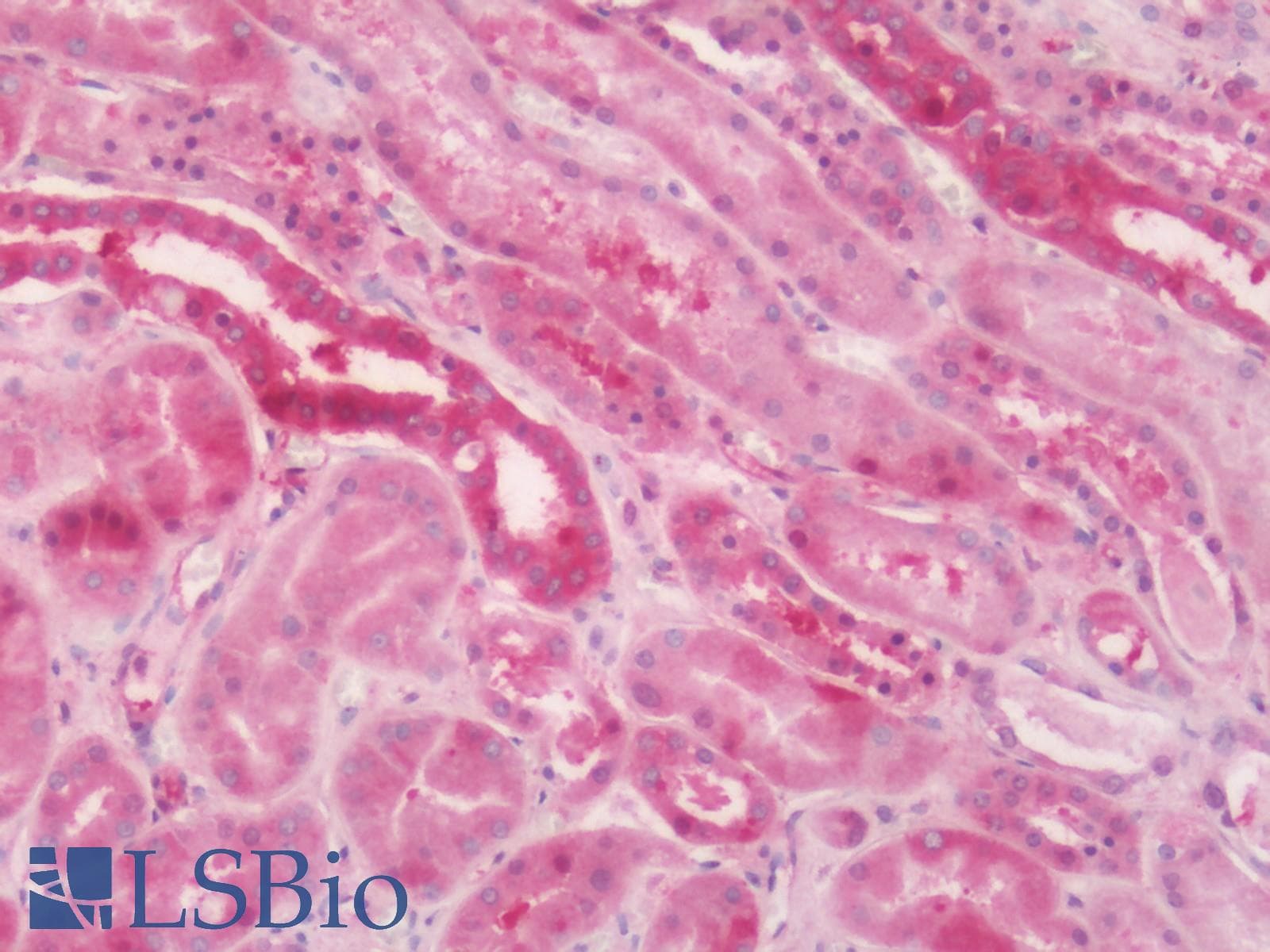 PathPlus™ Polyclonal Rabbit anti-Human MTNR1A / Melatonin Receptor 1a Antibody (Cytoplasmic Domain, IHC)