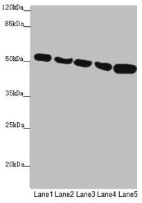 Polyclonal Rabbit anti-Human SUCLA2 Antibody (IHC, WB)