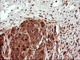 UPRT Antibody (clone OTI2F2)