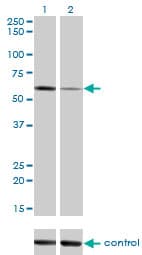 ALPPL2 Antibody (clone 2B3)