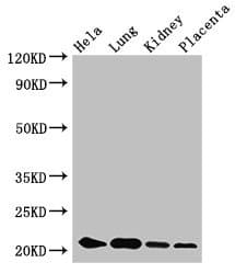 Polyclonal Rabbit anti-Human ZNF673 Antibody