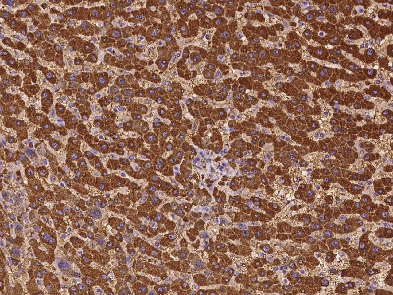 GAB2 Antibody