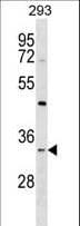 STX2 / Syntaxin 2 Antibody (aa60-89)