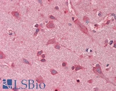 IHC-plus™ PTPN11 / SHP-2 / NS1 Antibody (aa321-370)