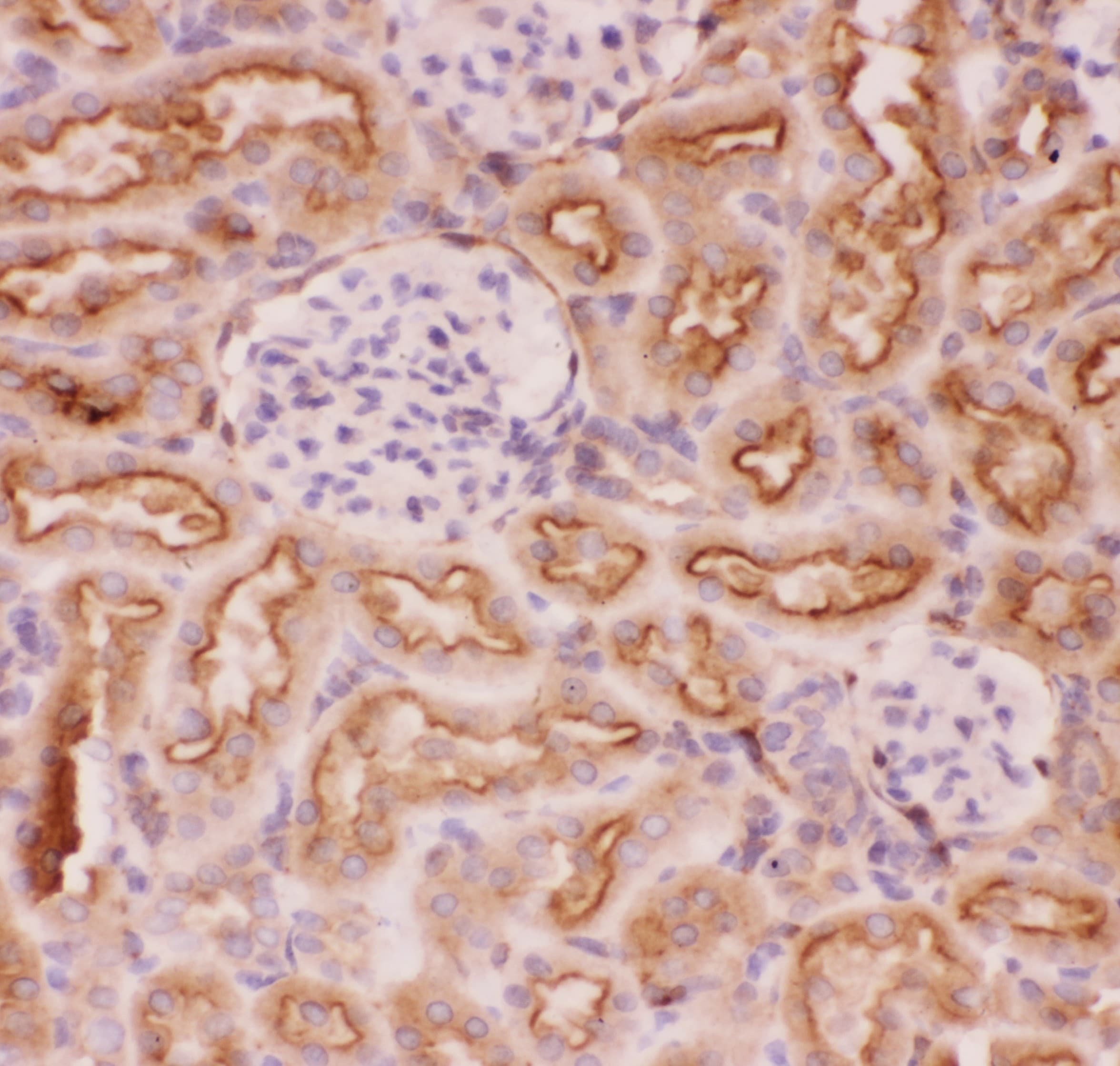 ABCB1 / MDR1 / P Glycoprotein Antibody (aa621-650)