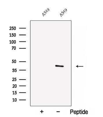 FAXDC2 / C5orf4 Antibody