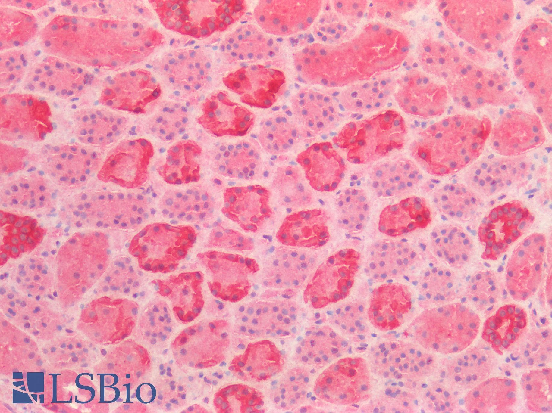 IHC-plus™ KRT19 / CK19 / Cytokeratin 19 Antibody (aa285-298)