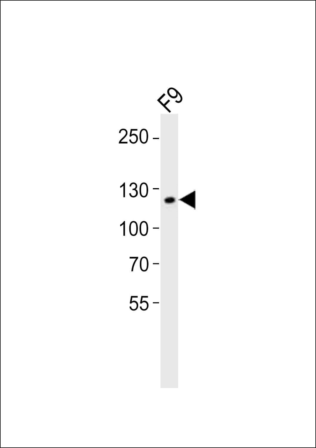 SIRT1 / Sirtuin 1 Antibody (aa566-601)